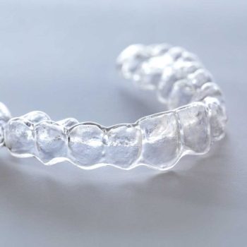 Invisalign Teeth