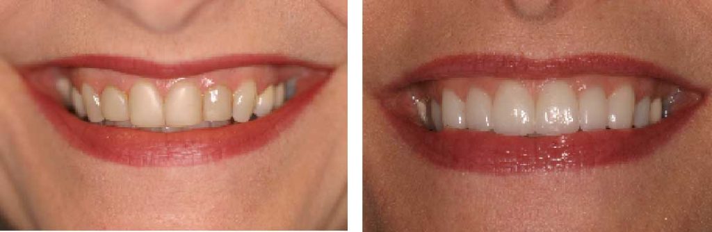 Dental before and after images