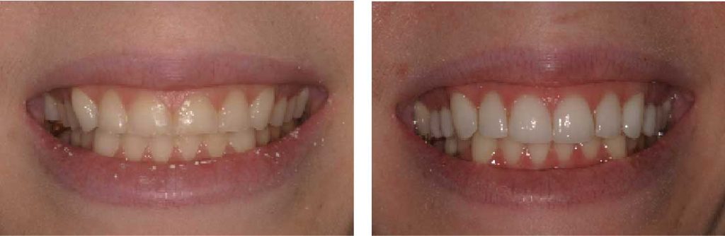 Dental before and after images