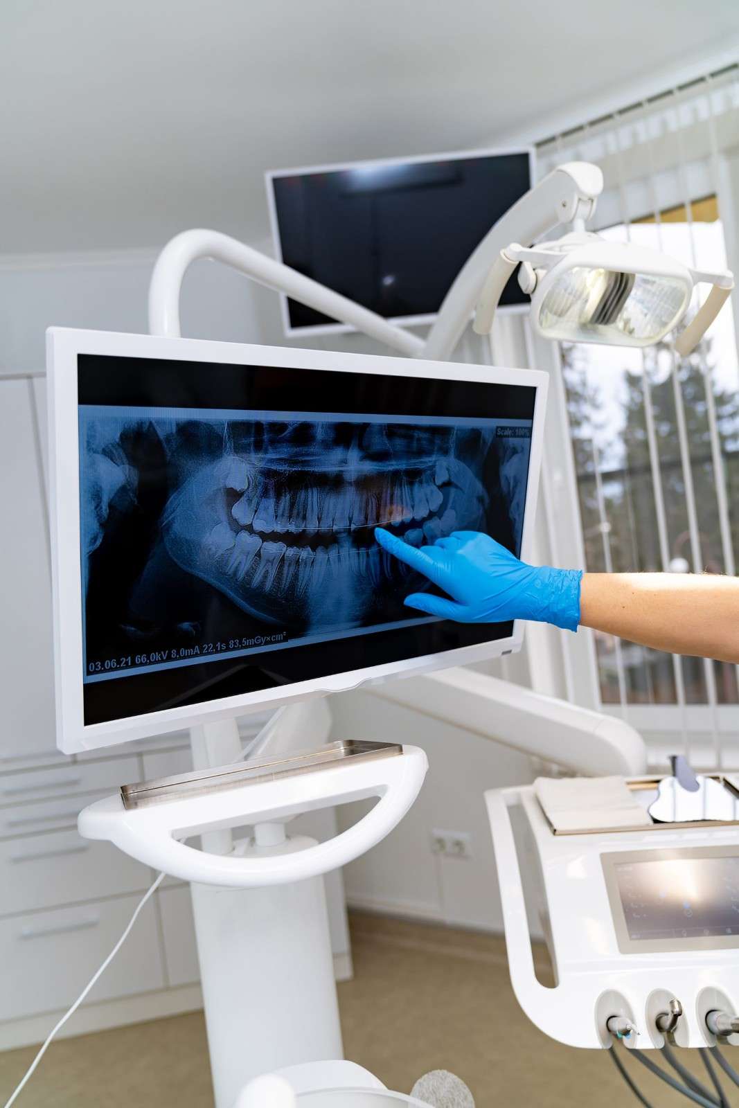 Dental professional in gloves